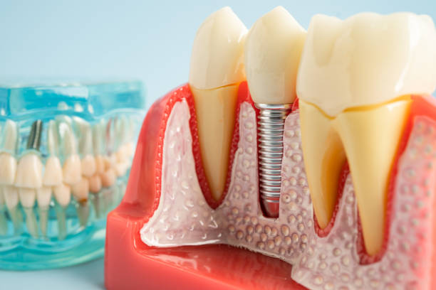 Best Dental Studio in Parkville, MD